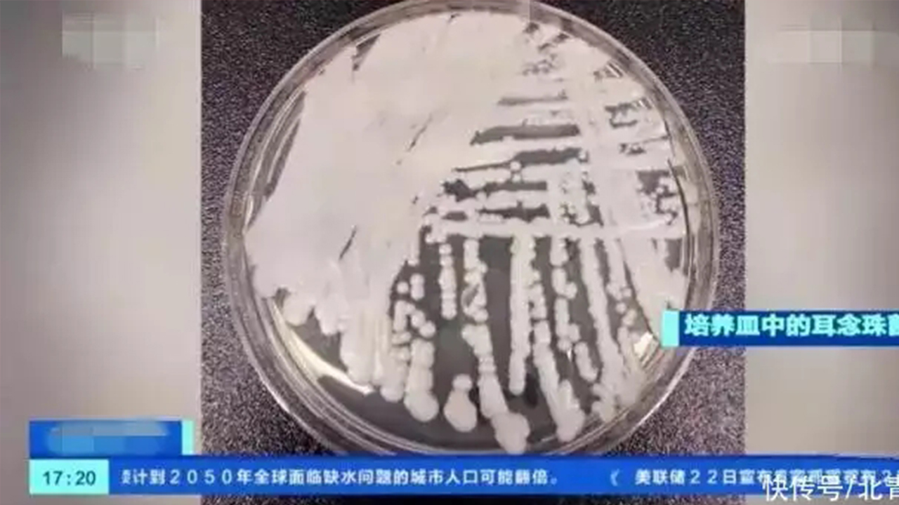 在美迅速傳播的耳念珠菌，我們需要擔心嗎